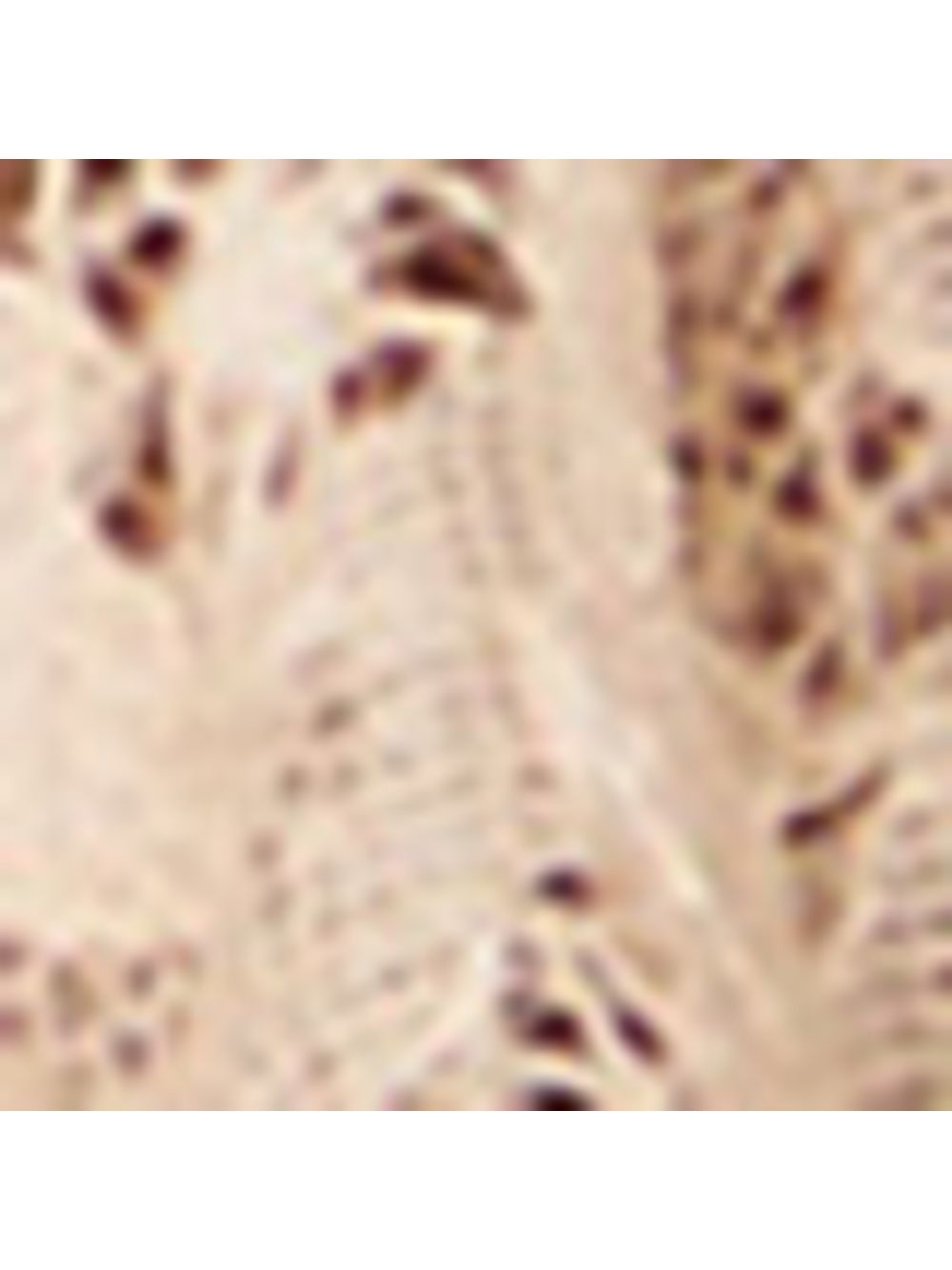 Animale — Top De Renda Com Babados Intimates